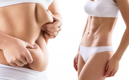 Emotional and Physical Recovery After Liposuction Surgery in Dubai
