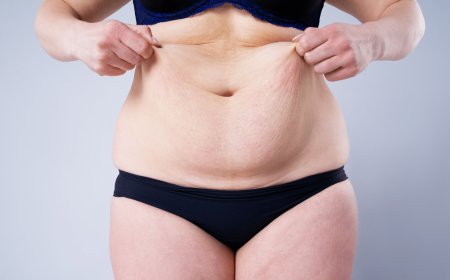 What Sets the Best Fat Transfer Surgeons in Dubai Apart from the Rest?