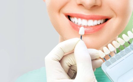 What You Need to Know About Veneers in Dubai: Procedure and Aftercare