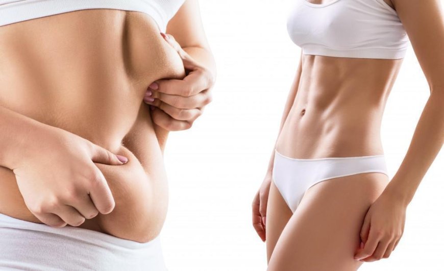 Emotional and Physical Recovery After Liposuction Surgery in Dubai