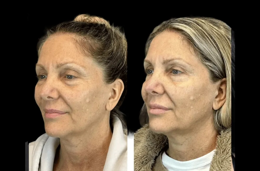 How to Choose the Best Aesthetic Clinic in Dubai for Personalized Skin Treatments