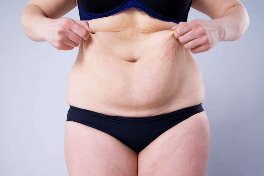 What Sets the Best Fat Transfer Surgeons in Dubai Apart from the Rest?