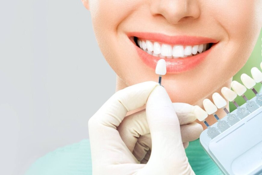 What You Need to Know About Veneers in Dubai: Procedure and Aftercare