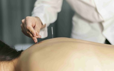 Feel Balanced Again with Acupuncture for Hormonal Balance