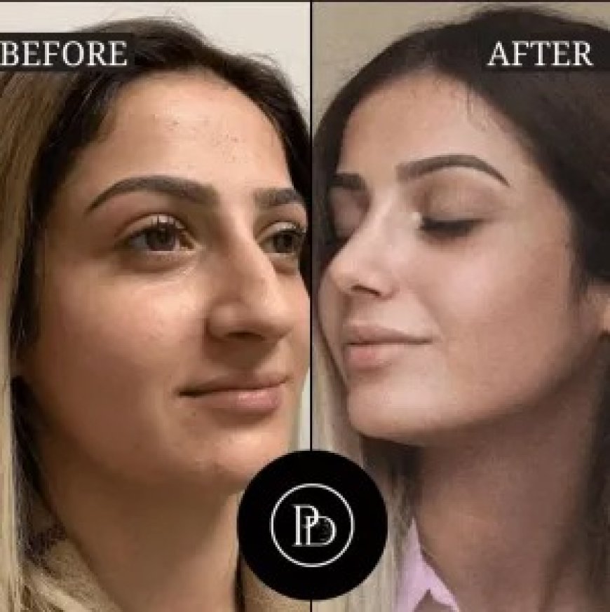 What Makes Perfectdrs the Best Aesthetic Clinic in Dubai? My Full Review