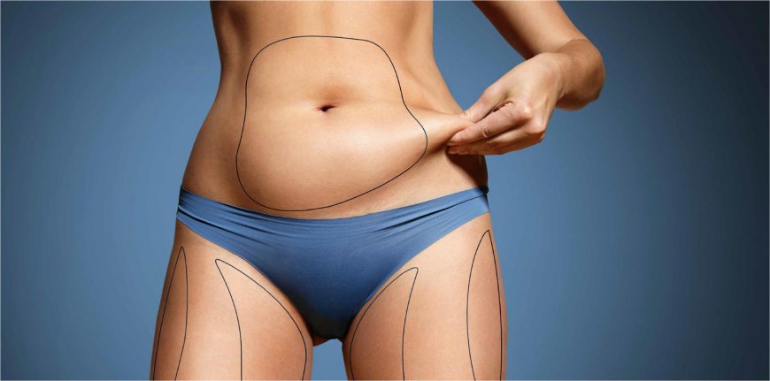 Abdominoplasty in Dubai: How to Choose the Right Clinic for Your Abdominoplasty Procedure