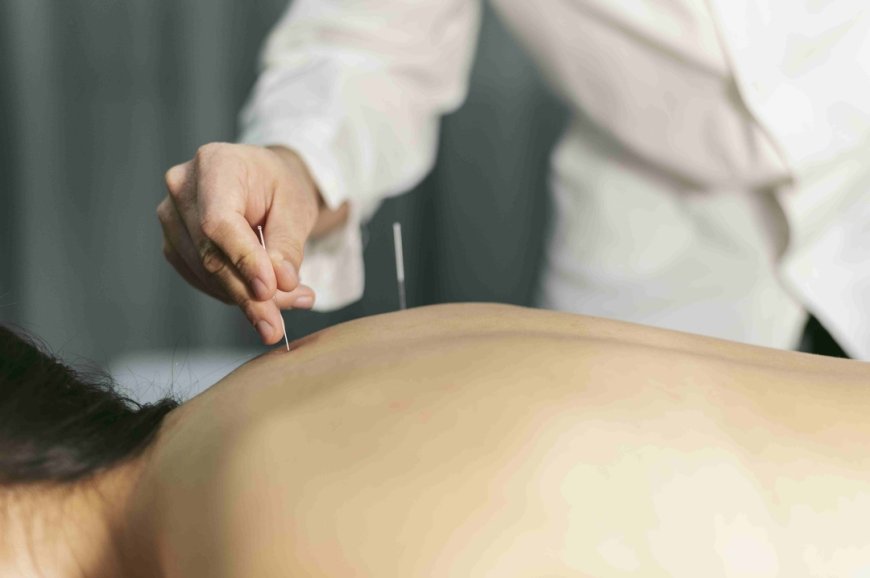 Feel Balanced Again with Acupuncture for Hormonal Balance