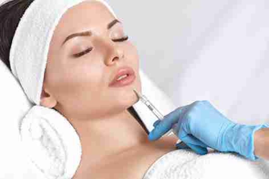  Directory Lip Fillers
